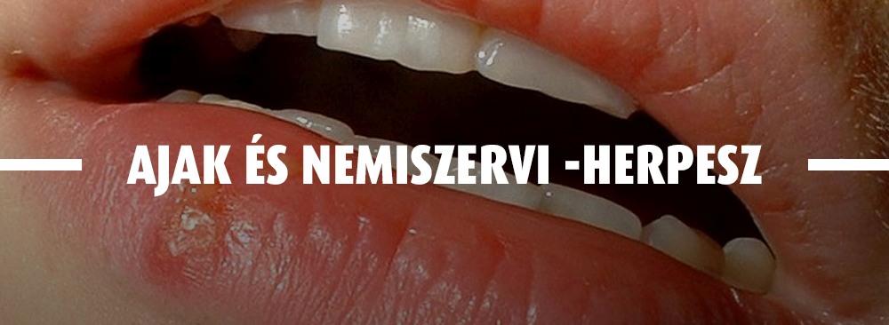 Herpeszről látványkép